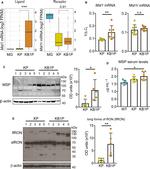 RON Antibody in Western Blot (WB)