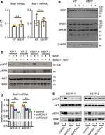 RON Antibody in Western Blot (WB)