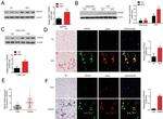 FBXW2 Antibody in Immunohistochemistry (IHC)