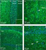 Estrogen Receptor beta Antibody in Immunohistochemistry (Frozen) (IHC (F))