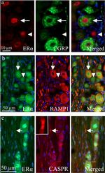 CGRP Antibody in Immunohistochemistry (IHC)