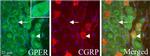 CGRP Antibody in Immunohistochemistry (IHC)