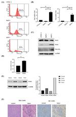 PRDX2 Antibody in Immunohistochemistry (IHC)