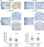 CD105 Antibody in Immunohistochemistry (IHC)