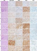 ETV1 Antibody in Immunohistochemistry (IHC)