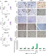 COL11A1 Antibody in Immunohistochemistry (IHC)
