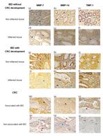 MMP7 Antibody in Immunohistochemistry (IHC)