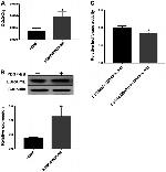 LURAP1L Antibody in Western Blot (WB)