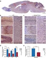 GABRG2 (extracellular) Antibody in Immunohistochemistry (IHC)
