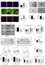 Catalase Antibody in Western Blot (WB)