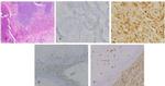 VEGF Antibody in Immunohistochemistry (IHC)