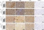 ABCG1 Antibody in Immunohistochemistry (IHC)