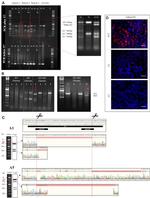 ADAM10 Antibody in Immunocytochemistry (ICC/IF)
