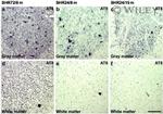 Phospho-Tau (Ser202, Thr205) Antibody in Immunohistochemistry (IHC)