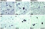 Phospho-Tau (Ser202, Thr205) Antibody in Immunohistochemistry (IHC)