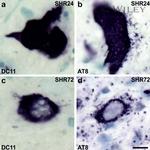 Phospho-Tau (Ser202, Thr205) Antibody in Immunohistochemistry (IHC)
