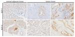 KIF11 Antibody in Immunohistochemistry (IHC)