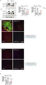 LOX Antibody in Western Blot (WB)