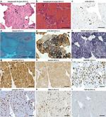 SMPX Antibody in Immunohistochemistry (IHC)