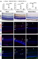 NLRP3 Antibody in Immunohistochemistry (IHC)