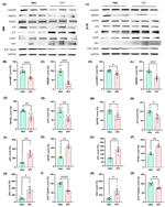 Lamin B1 Antibody in Western Blot (WB)