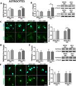 TMPRSS2 Antibody in Western Blot (WB)