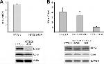 Hepatitis C Virus Core Antigen Antibody in Western Blot (WB)