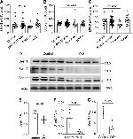 SESN1 Antibody in Western Blot (WB)