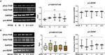 proBDNF Antibody in Western Blot (WB)