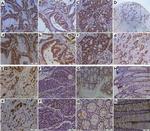 POM121 Antibody in Immunohistochemistry (IHC)