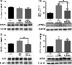Phospho-PP2A alpha (Tyr307) Antibody in Western Blot (WB)