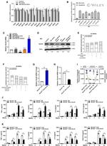 SOCS6 Antibody in Western Blot (WB)