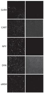 GnRH1 Antibody in Immunocytochemistry (ICC/IF)