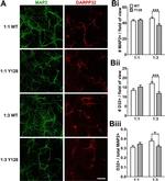 MAP2 Antibody in Immunocytochemistry (ICC/IF)
