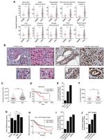 Caspase 8 Antibody in Immunohistochemistry (IHC)