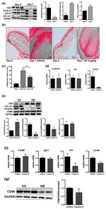 Alpha-Smooth Muscle Actin Antibody in Western Blot (WB)