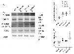 RyR2 Antibody in Western Blot (WB)