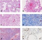 SARS Coronavirus Nucleocapsid Antibody in Immunohistochemistry (IHC)