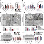Phospho-DRP1 (Ser616) Antibody in Western Blot (WB)