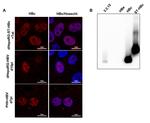 Hepatitis B Virus Core Antigen Antibody in Immunocytochemistry (ICC/IF)