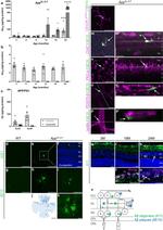 Oligomer A11 Antibody in Immunohistochemistry (PFA fixed), Immunocytochemistry (IHC (PFA), ICC/IF)