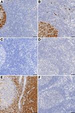 CD4 Antibody in Immunohistochemistry (Paraffin) (IHC (P))