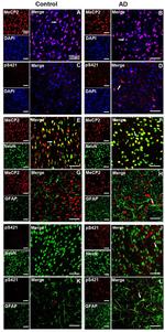 Phospho-MECP2 (Ser421) Antibody in Immunocytochemistry (ICC/IF)