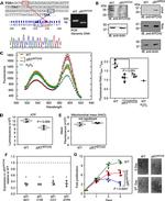 MTCH2 Antibody in Western Blot (WB)