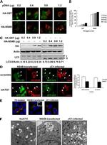 Hepatitis C Virus Core Antigen Antibody in Immunohistochemistry (IHC)