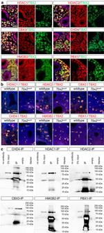 HDAC1 Antibody in Immunohistochemistry (Paraffin), Immunocytochemistry (IHC (P), ICC/IF)