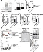 Cathepsin S Antibody in Western Blot (WB)