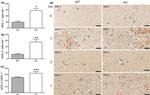 Arginase 1 Antibody in Immunohistochemistry (IHC)