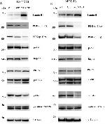 PKC alpha Antibody in Western Blot (WB)