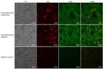 Chikungunya Virus Antibody in Immunocytochemistry (ICC/IF)